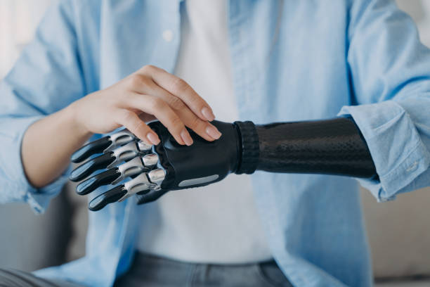 Cyber hand of female amputee. Disabled woman is changing settings of bionic arm. Electronic sensor hand has processor and buttons. High tech carbon robotic prosthesis. Medical technology and science.